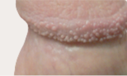 ppp before after results nyc